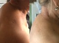 Фотография: Тейпирование