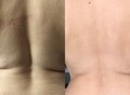 Фотография: Тейпирование