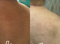 Фотография: Тейпирование