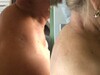 Фотография: Тейпирование